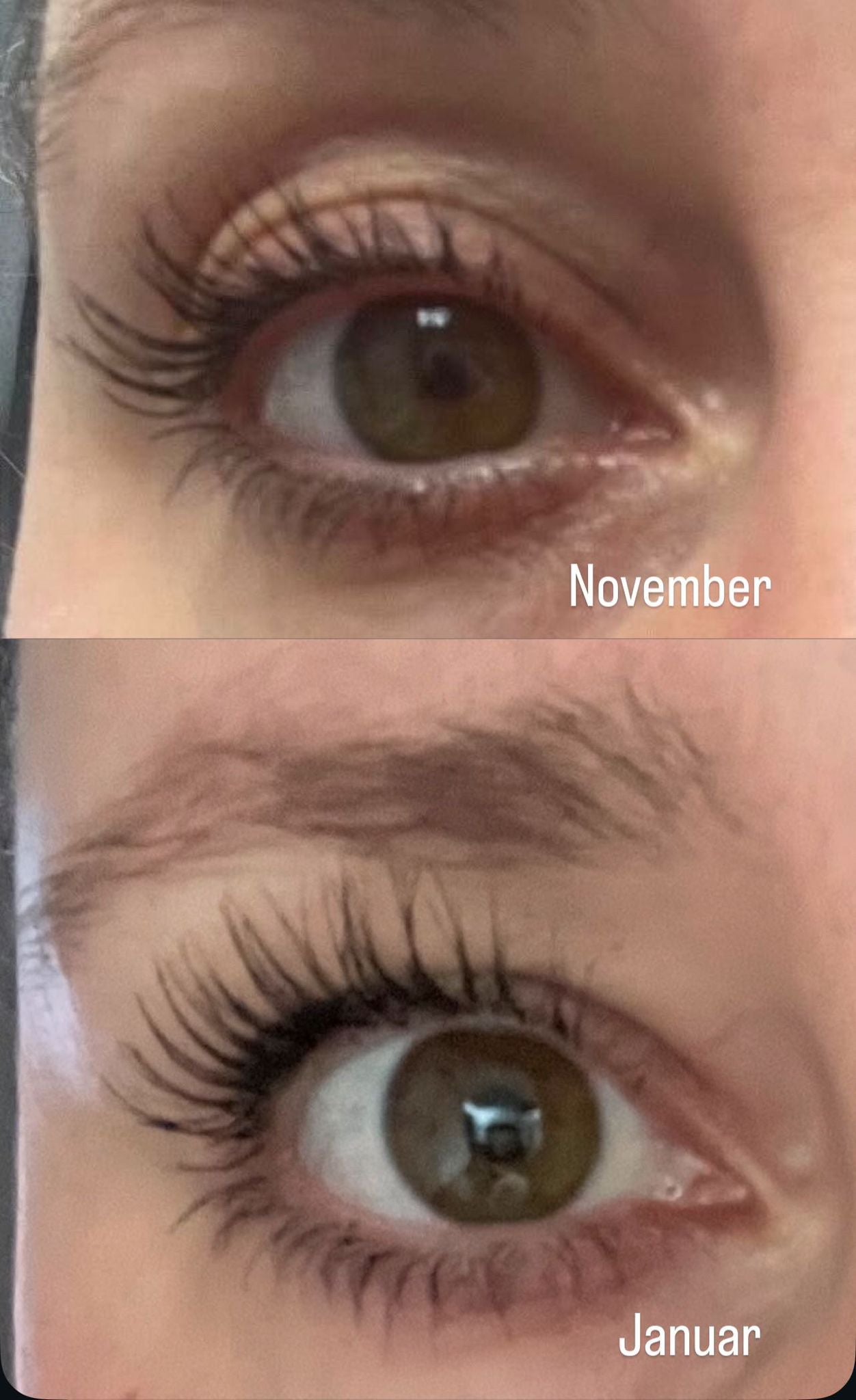 Wimpernserum 5ml – Hormonfrei für längere, dichtere und gesündere Wimpern